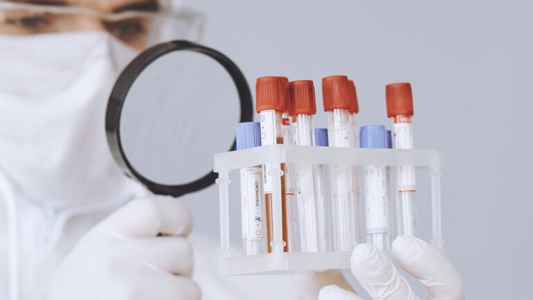 Ensaio epidemiológico