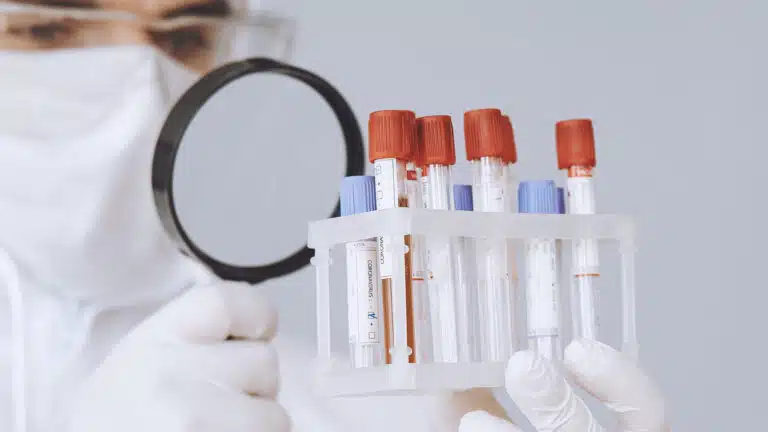 Ensaio epidemiológico